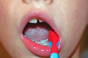 Tooth aktiviteter for børnehave