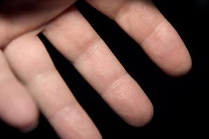 Hvad er årsagerne til Pins & Needles i Fingers?